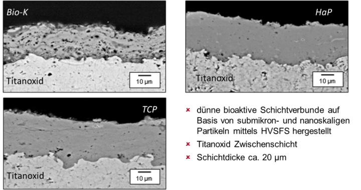 Bild 2. Über HVSFS Verfahren hergestellte Beschichtungen aus einem Bioglas (Bio-K), Hydroxylapatit (HaP) und Tricalziumphophat (TCP).